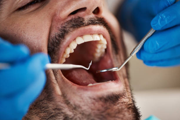 Best Emergency Broken Tooth Repair in Pasco, WA